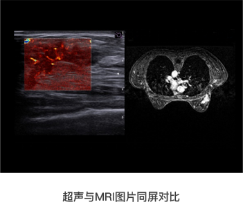 超声与MRI图片同屏对比.png