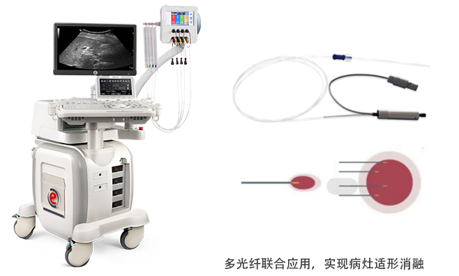 sdwd多光纤联sdsf合应用sd - 副本.jpg